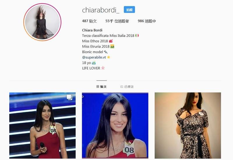 意大利选美比赛名单出炉 残疾正妹Chiara Bordi获季军