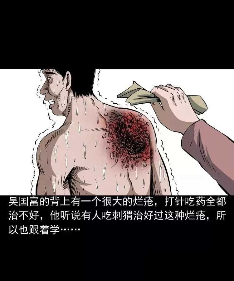 恐怖漫画推荐《吃刺猬的人》 为治怪病吃吃刺猬险丧命