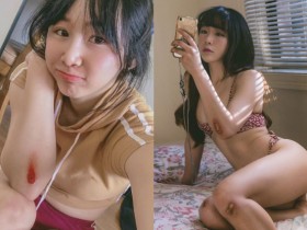 【6upoker】「機機Shacy」受傷不忘放曬火辣美體,「渾圓蜜臀」讓男粉邊心疼邊享受!